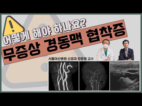 [경동맥협착증] 무증상으로 발견된 경동맥 협착증, 수술이나 시술 꼭 필요할까요? (서울아산병원 신경과 장준영 교수) Asymptomatic proximal ICA stenosis