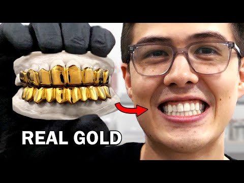 Making custom gold grillz (to avoid crippling embarrassment)
