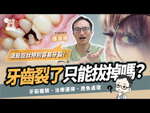 😱 牙齒為什麼會牙裂？ 牙裂就要拔牙了嗎？牙髓病專科醫師：破解【牙冠裂/牙根裂】五大元兇！症狀判斷、常見成因、日常保護與治療
