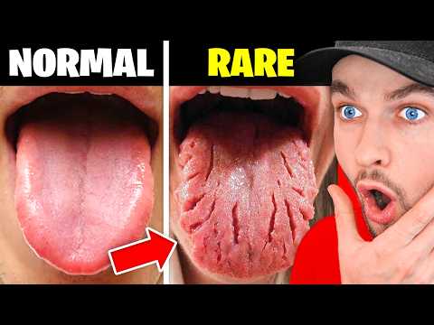 Rare People You WON’T Believe Exist!