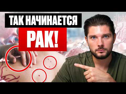 YOUR BODY IS SCREAMING FOR HELP! 10 Hidden Cancer Signs You're Ignoring