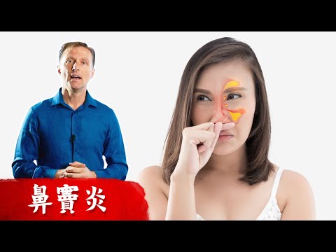 鼻塞、鼻竇炎的2種自然療法,柏格醫生 Dr Berg