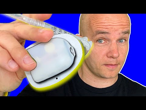 Omnipod 5 Tutorial: How to Apply Your First Pod