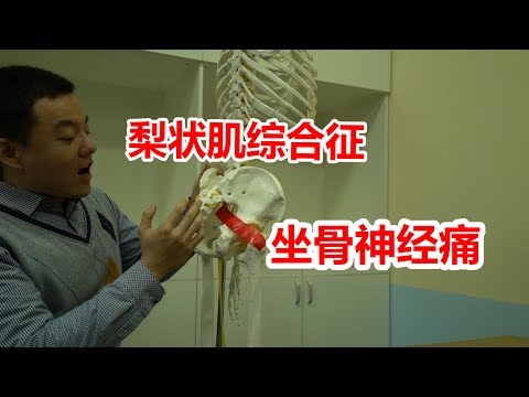 坐骨神经痛？屁股疼、腿疼、脚疼，腰不疼？怀疑梨状肌综合征
