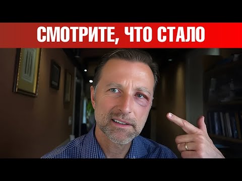 Вот до чего дошло...😲 Стресс, кортизол, преднизон.