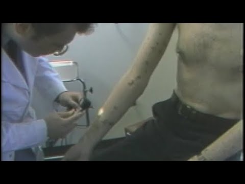 1983 NEWS SPECIAL: Diagnosis ( EARLY AIDS DOCUMENTARY )