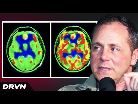 Neuroscientist Reveals Weird Supplement That Gave Him a New Brain