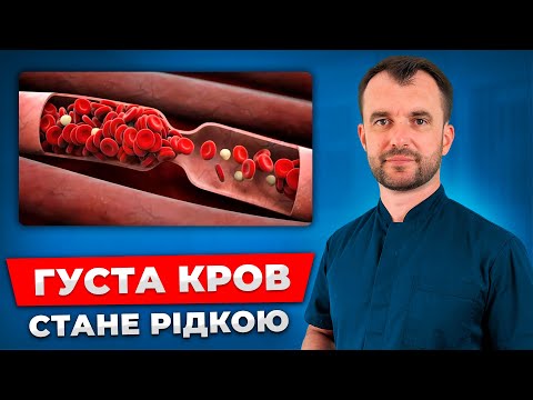 Розрідження густої крові БЕЗ ТАБЛЕТОК! З'їжте ці продукти