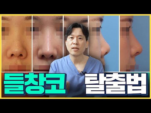 실제 케이스로 보는 '들창코' 수술 방법!