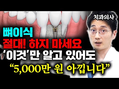 뼈이식 임플란트 "모르면 99% 사기 당합니다" 녹아내리는 잇몸을 위한 확실한 방법 (백승우 원장 2부)