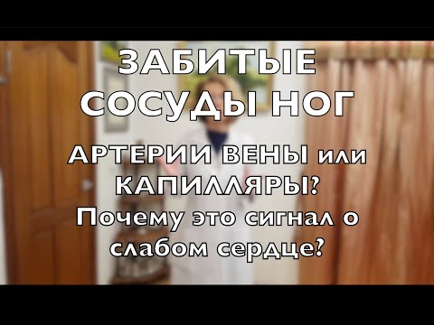 ЗАБИТЫЕ СОСУДЫ ног. Как именно бывают забиты и почему КАРДИОЛОГ всегда интересуется ногами?