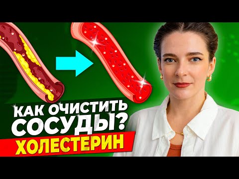 КАК СНИЗИТЬ ХОЛЕСТЕРИН? Как очистить сосуды от холестерина? Плохой и хороший холестерин (ЛПНП/ЛПВП)