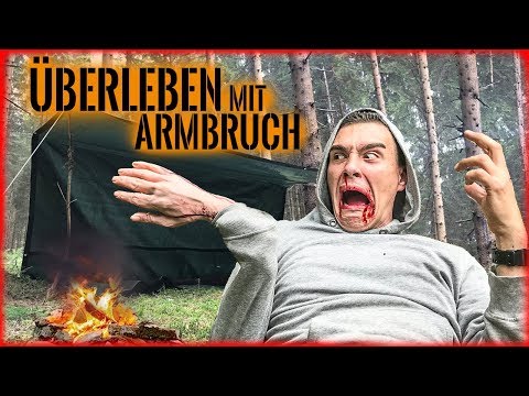 SURVIVING with a BROKEN ARM in the WILDERNESS | FIRE SHELTER FOOD | Survival Mattin