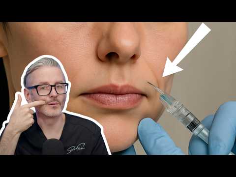 Avoid This Nasolabial Filler Mistake That Ages Patients [+ What To Do Instead For Youthful Results]