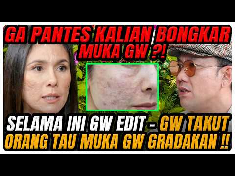 NETIZEN BONGKAR MUKA WULAN ASLINYA GRADAKAN‼️ SAMPAI KE PSIKOLOG-NANGIS-HINGGA LUKA BR*K3N HOME ⁉️