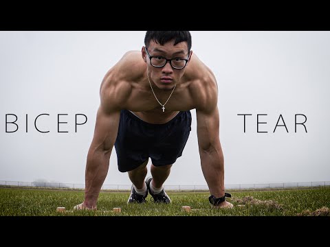 biomechanics of bicep tear