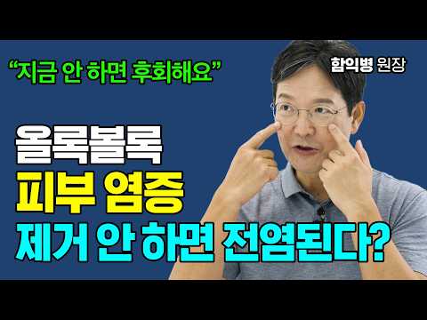 오돌토돌 피부 염증! 레이저로 치료되나요? feat. 편평사마귀, 비립종, 한관종, 쥐젖 [함익병 원장]