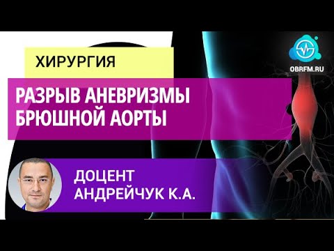 Доцент Андрейчук К.А.: Разрыв аневризмы брюшной аорты
