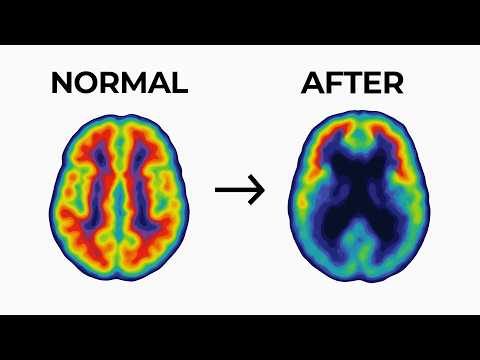 Top 10 HIDDEN Risks of SSRIs