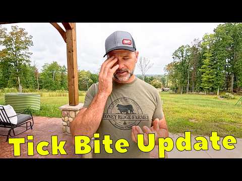 TICK BITE that Changed My Life Forever | 6 Weeks Later this Happened!