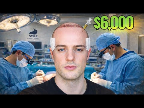 I Flew 8500 KM to Turkey for a Hair Transplant! (Full Journey) @SmileHairClinic
