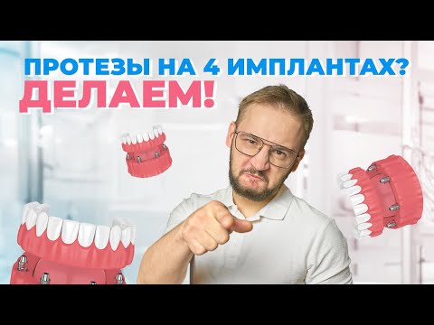 All-on-4 протезирование. Вся правда о методике протезирования All-on-4!