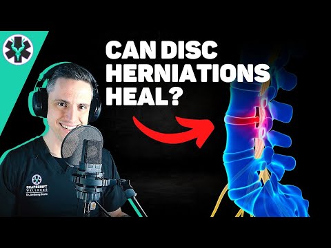 Can Disc Herniations & Disc Bulges Heal On Their Own? How to Fix Low Back Pain