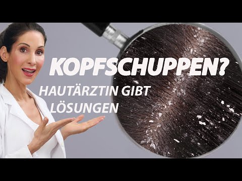 Haarschuppen & juckende Kopfhaut endlich los werden! - Hautärztin klärt auf I DoktorJulie