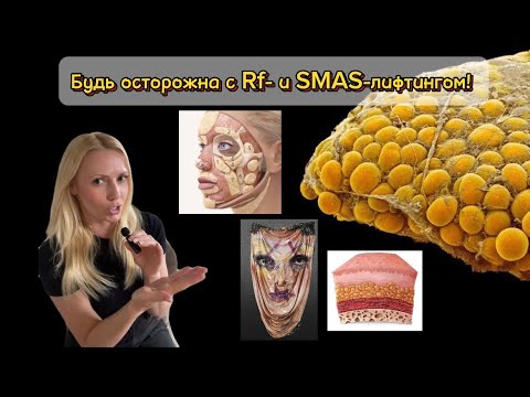 Стоит ли делать рф-лифтинг или смас-лифтинг? И чем опасны липолитики?О чем не расскажут косметологи?