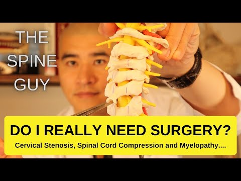 What is Cervical Stenosis and Spinal Cord Compression. DO I REALLY NEED SURGERY?