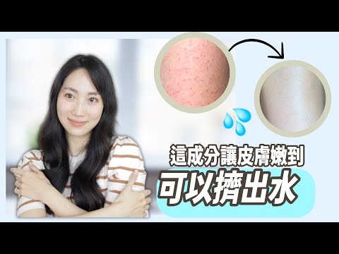 【我最愛用它全身去角質】解決皮膚粗糙，膚色黑，角化症@DrGrace