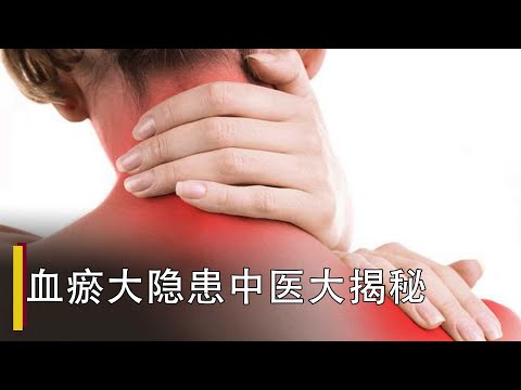 【中华养生秘籍】血瘀隐藏的危害你知道吗？中医化瘀止血的药 包你药到病除