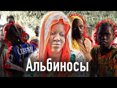 Как альбиносы в Африке становятся изгоями, жертвами колдунов и изнасилований / Сенегал