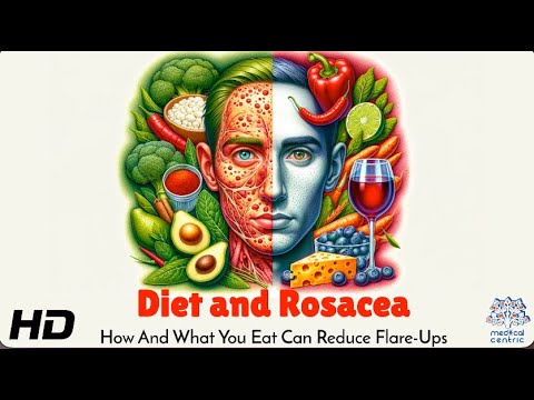 Rosacea Flare-Ups? Discover These Anti-Inflammatory Foods