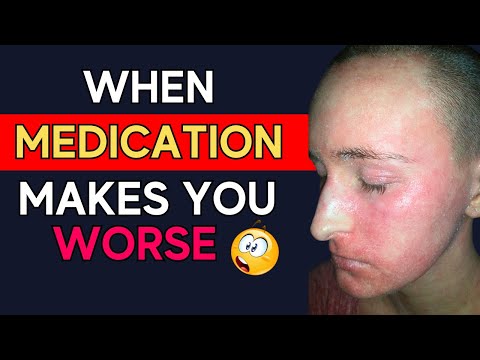 Addicted To Topical Steroids? (Truth About Topical Steroid Withdrawal TSW) | Briana Banos