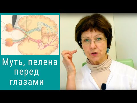Муть в глазах, пелена перед глазами - что это значит и что делать?