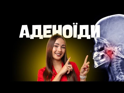 Як лікувати аденоїди правильно і уникнути ускладнень.  Анна Юшковська. Лікар-отоларинголог. Сурдолог
