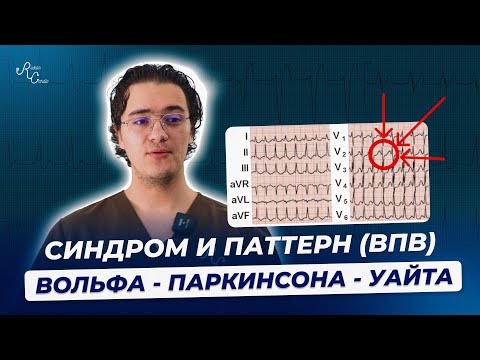 Синдром и паттерн ВПВ. Вольфа - Паркинсона - Уайта