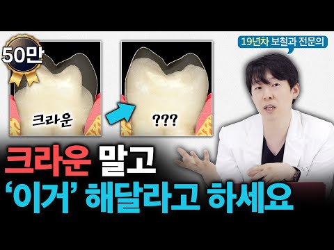 내 치아 최대한 지키는 방법 “크라운 권하면 이렇게 말하세요”