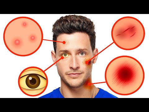 Skin Changes You Shouldn’t Ignore