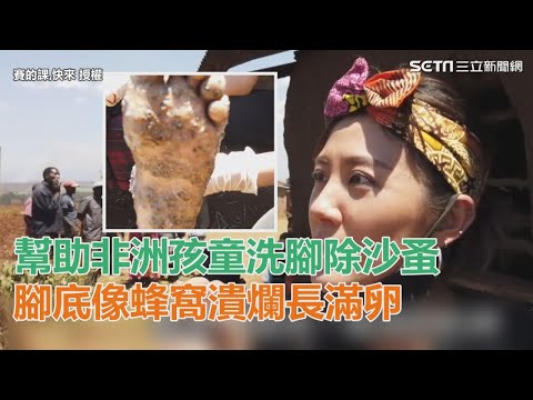 幫助非洲孩童洗腳除沙蚤 腳底像蜂窩潰爛長滿卵|三立新聞網SETN.com