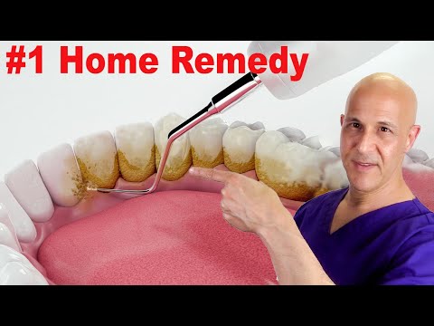 #1 Home Remedy to Remove Dental Plaque & Tarter to Prevent Cavities | Dr. Mandell