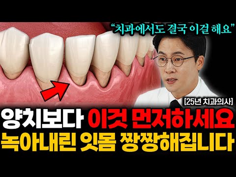 25년 치과의사 영업비밀. 양치질보다 '이것' 먼저하면 잇몸병 싹! 사라집니다 (장혁진 원장 통합본)