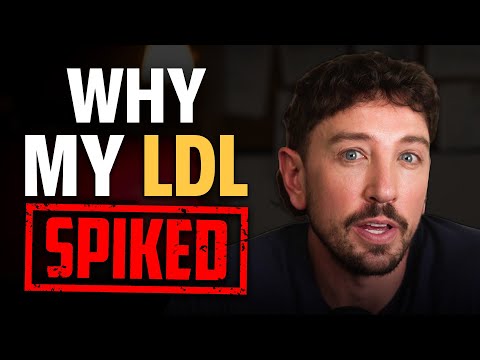 Why Small Diet Changes Spiked My LDL & ApoB | Blood Tests, Cholesterol & Plaque Risk | EP #372