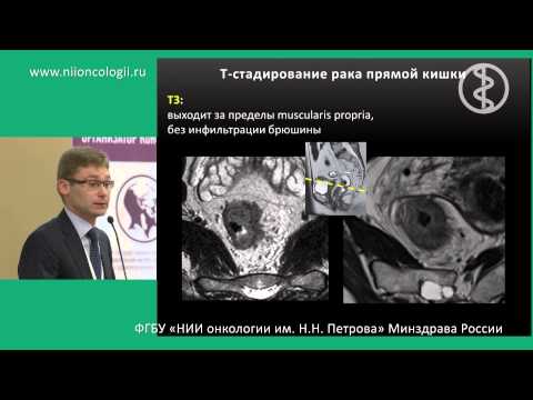 МРТ в стадировании и оценки лечения рака прямой кишки (Английская версия) (К.С. Петров)