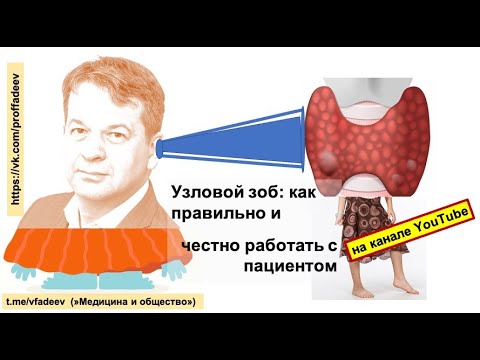 Узловой зоб: как правильно и честно работать с пациентом