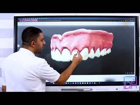 Removable Prosthodontics Complete Denture 5- CD Components and its Significance