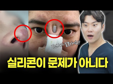 염증은 과연 실리콘 때문일까? (코수술 부작용 2편)