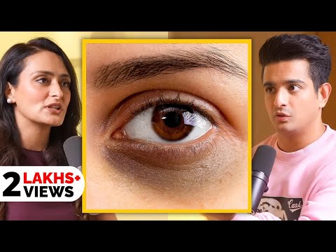 EASY Home Remedies For Dark Circles - Free Advice From Top Skin Doctor