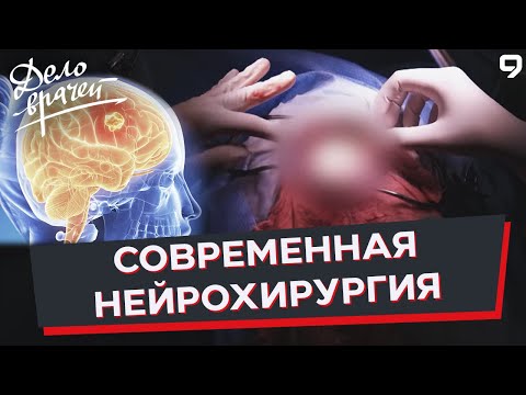 Программа "Дело врачей". Удаление опухоли мозга. Нейрохирургия. Глиобластома